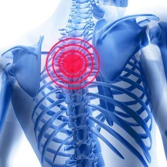 Dor torácica con osteocondrose torácica