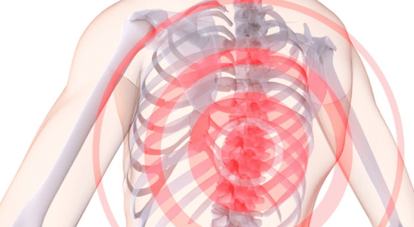 Dor na columna vertebral con osteocondrose torácica